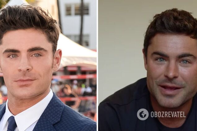 У мережі бурхливо обговорюють змінену зовнішність Зака Ефрона