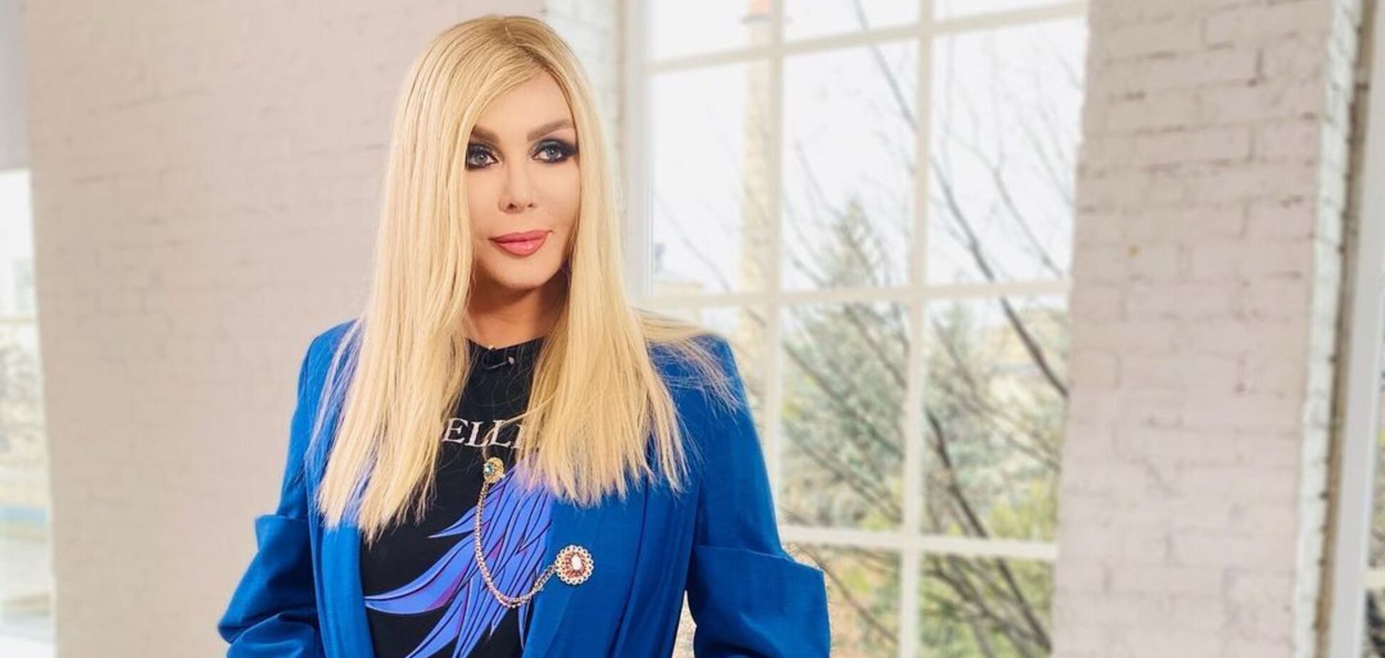 Билык – о пластике и подтяжках лица: надо мной все издевались