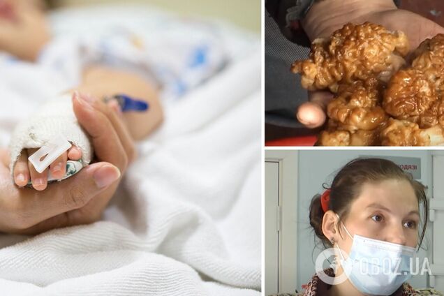 Отравление грибами