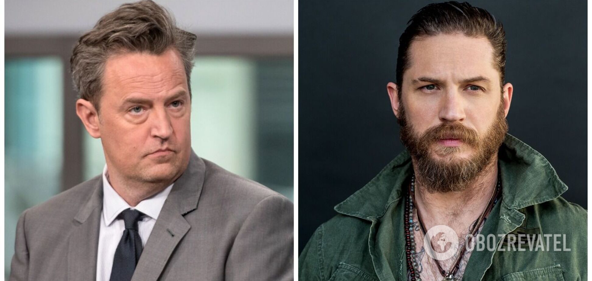 Третий сосок и заячья губа: Том Харди, Мэттью Перри и другие звезды с особенностями тела. Фото