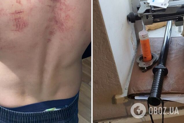 Пытки в полиции на Черкасщине: еще трем копам сообщили о подозрении. Фото