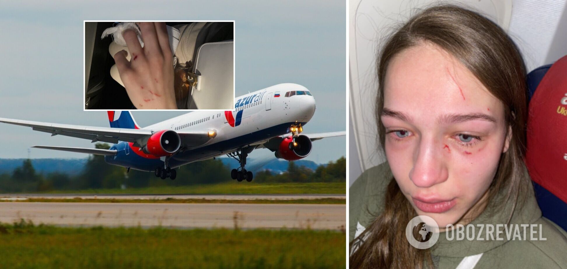 Украинке в самолете расцарапали лицо и отгрызли ноготь: блогер рассказал детали. Фото и видео