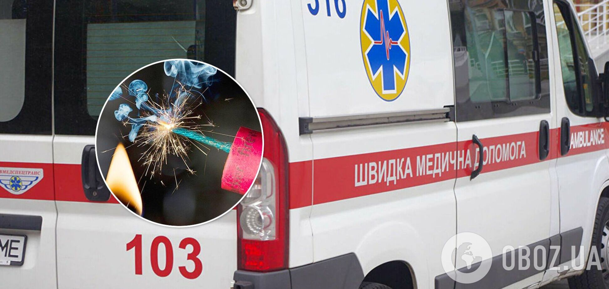 В Харькове ребенку оторвало пальцы взрывом петарды