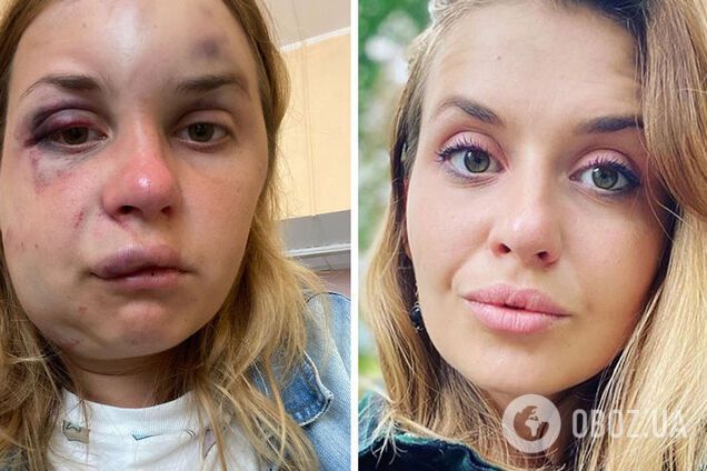 Справу закрито у зв'язку зі смертю обвинуваченого