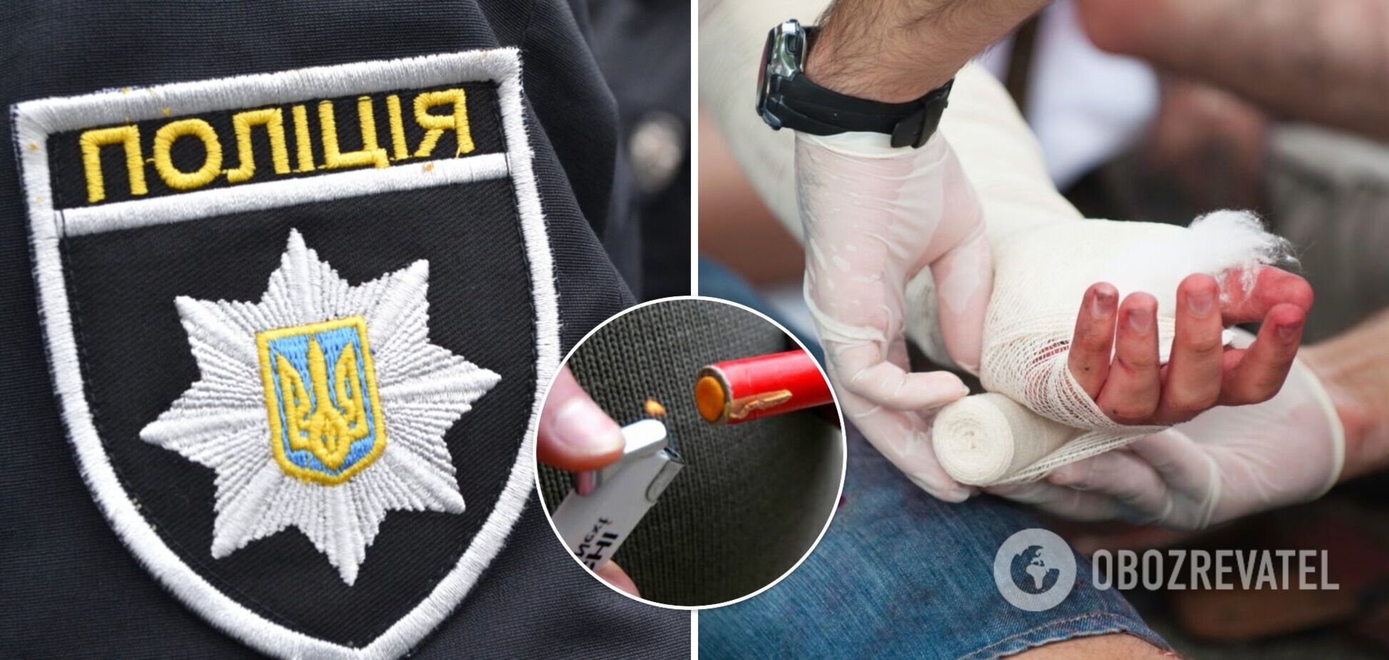 На Одещині школяр підірвав петарду в руці посеред уроку