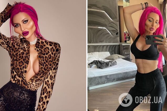 Украинка с огромными скулами стала звездой в Британии и рассказала о предстоящей пластике