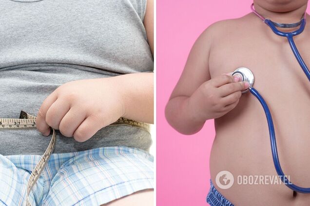 Дети могут набирать вес из-за мутации гена