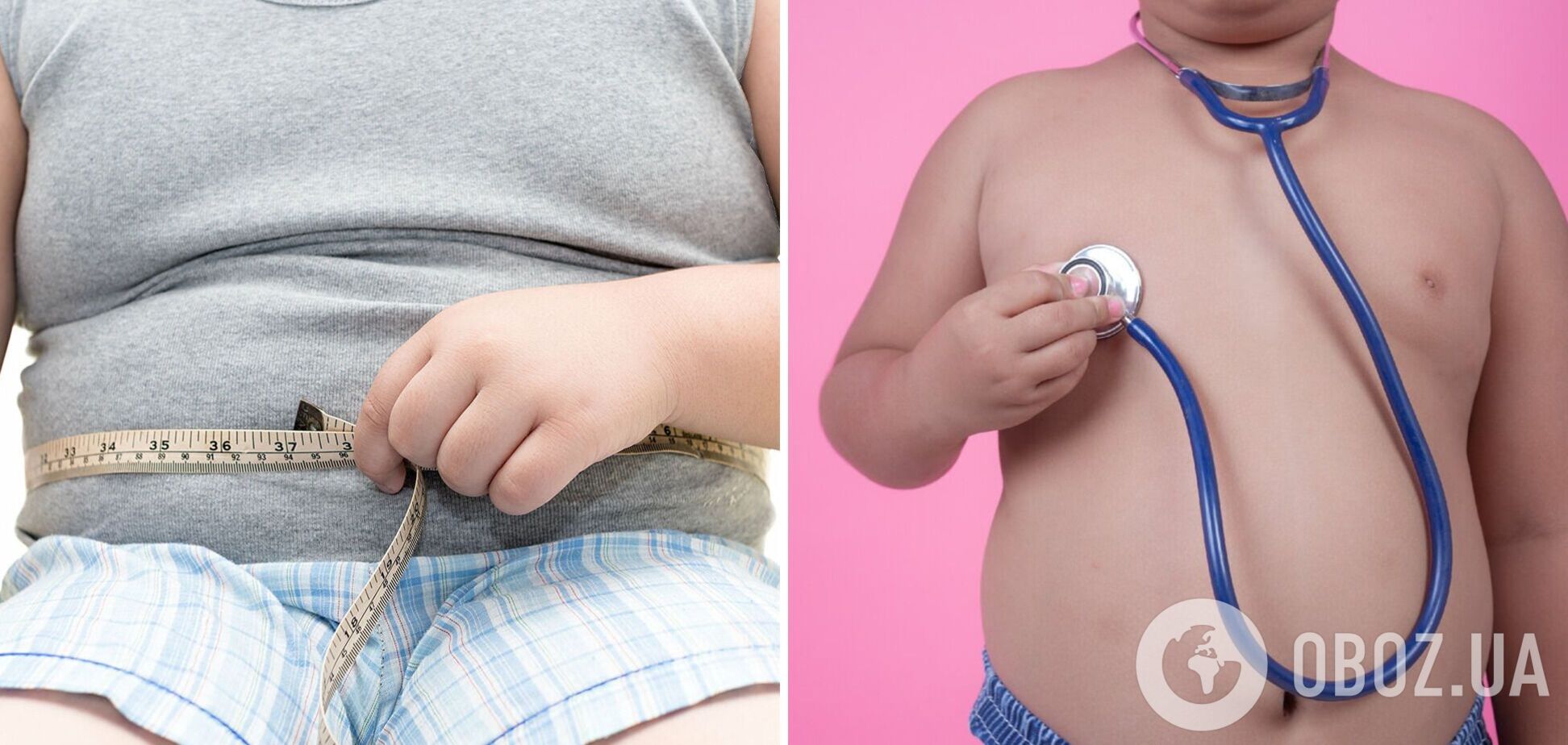 Діти можуть набирати вагу через мутацію гена