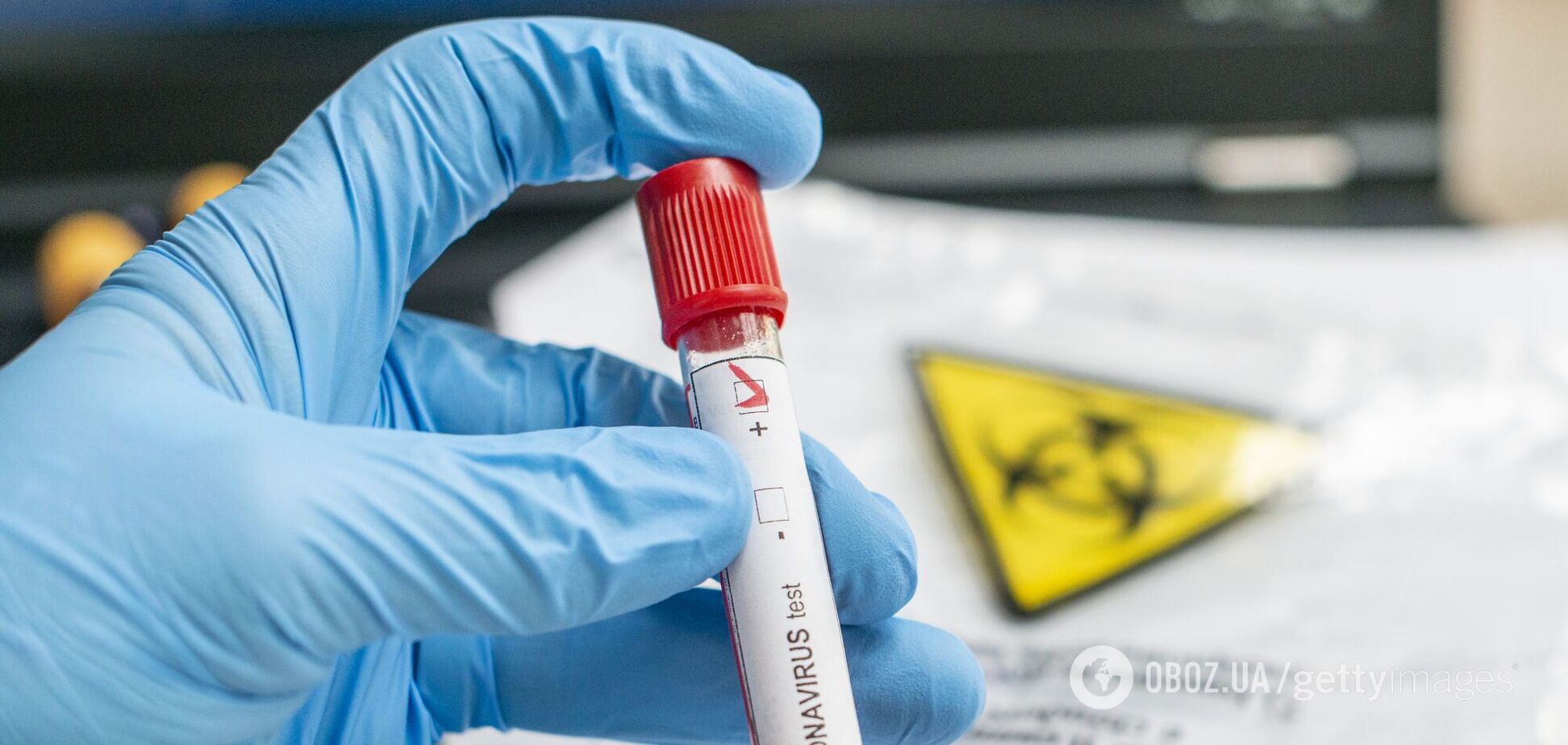 Тест на коронавирус