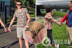 Пара, которая четыре месяца прожила на цепи, решила закончить отношения и снять оковы