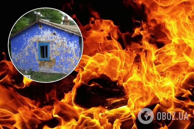 На Одесщине дети разлили бензин и получили глубокие ожоги