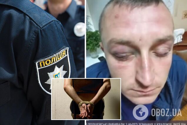 На Сумщине инкассатор заявил об пытках полицией: выбивали признания и держали за ноги с моста