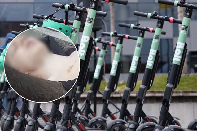 В Киеве мужчина на самокате упал на металлический штырь и травмировал грудь. Видео