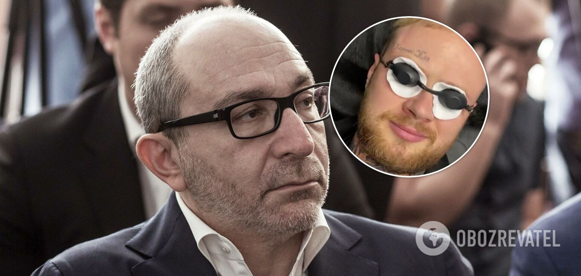 Харьковчанин стер со лба татуировку 'Кернес жив'. Видео