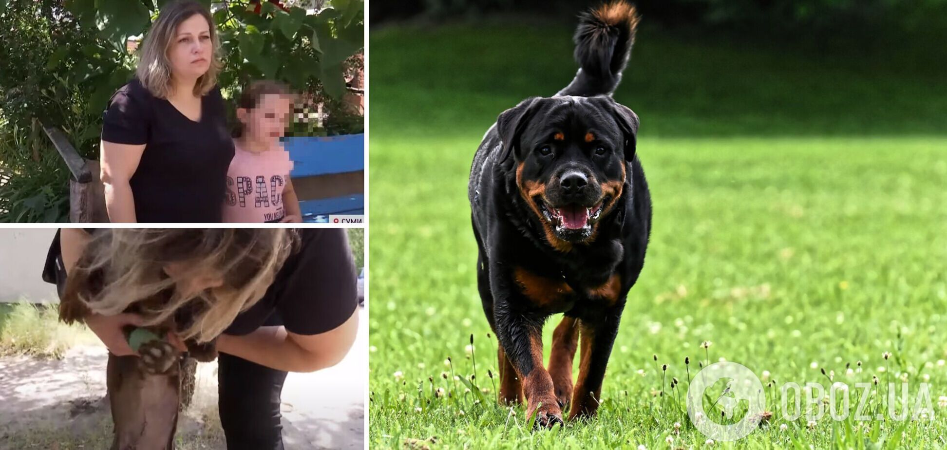 В Сумах собаки охранников набросились и искусали отца с 8-летним ребенком. Видео