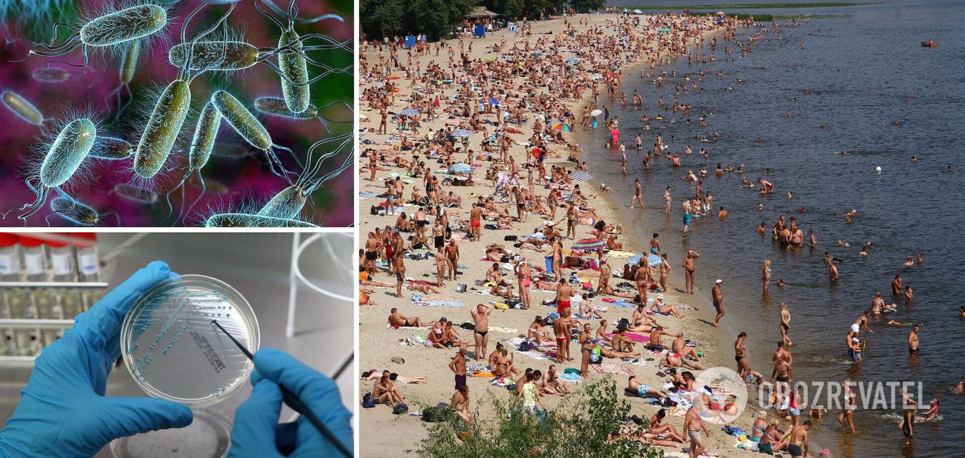 На пляжах Киева нашли кишечную палочку