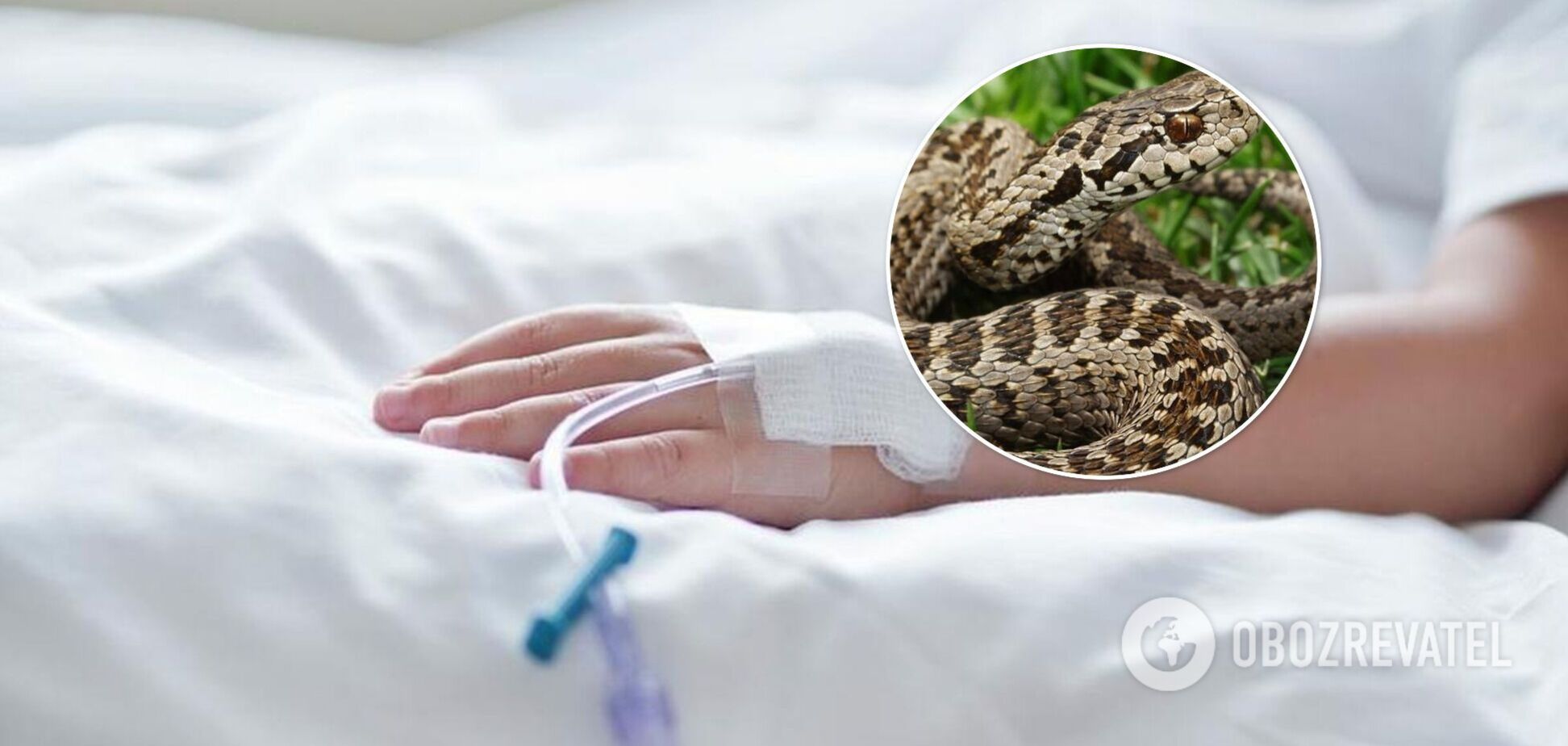 На Львівщині дівчина потрапила в реанімацію через укус змії