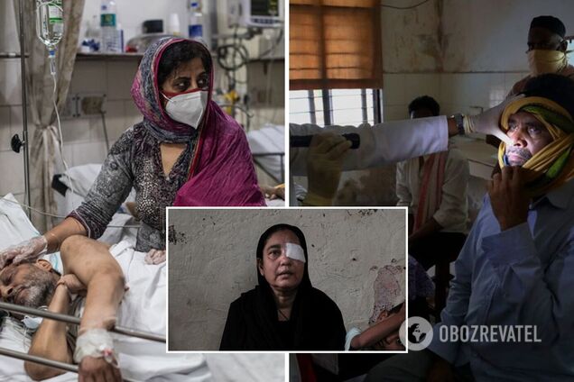 Індію вразив 'чорний грибок': історії пацієнтів, які після COVID-19 втратили зір. Фото