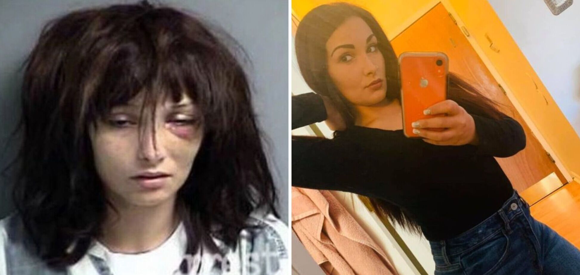 Девушки после отказа от наркотиков стали красотками. Фото до и после
