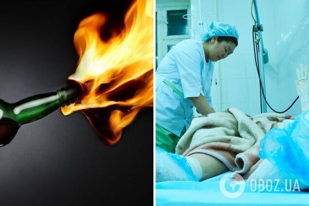 В Днепре скончался 12-летний мальчик, который себя поджег