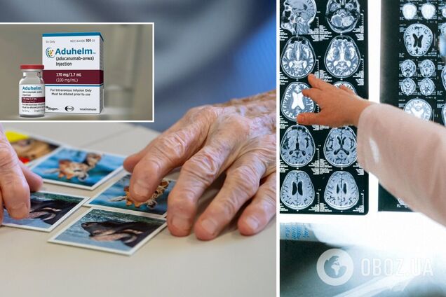 Нові ліки від хвороби Альцгеймера схвалили вперше за 20 років