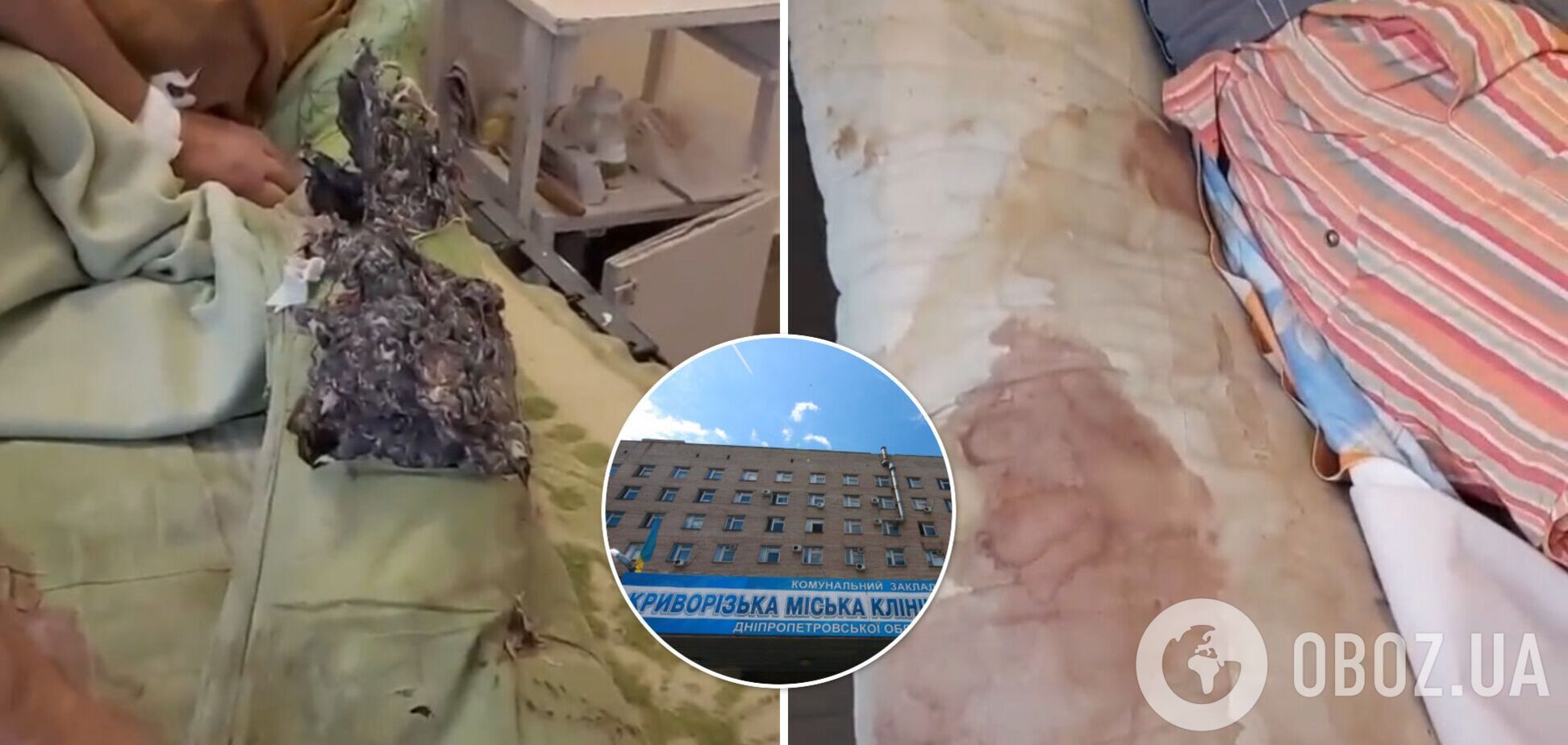 Житель Кривого Рога показал ужасные условия хирургии городской больницы: матрасы в моче и крови. Видео