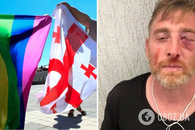 В Грузии умер телеоператор, избитый во время акции в поддержку ЛГБТ