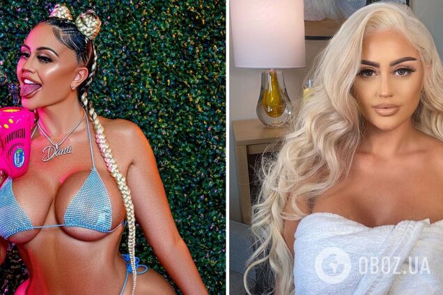 21-летняя модель спустила 10 тысяч долларов на увеличение ягодиц и сильно пожалела об этом. Фото