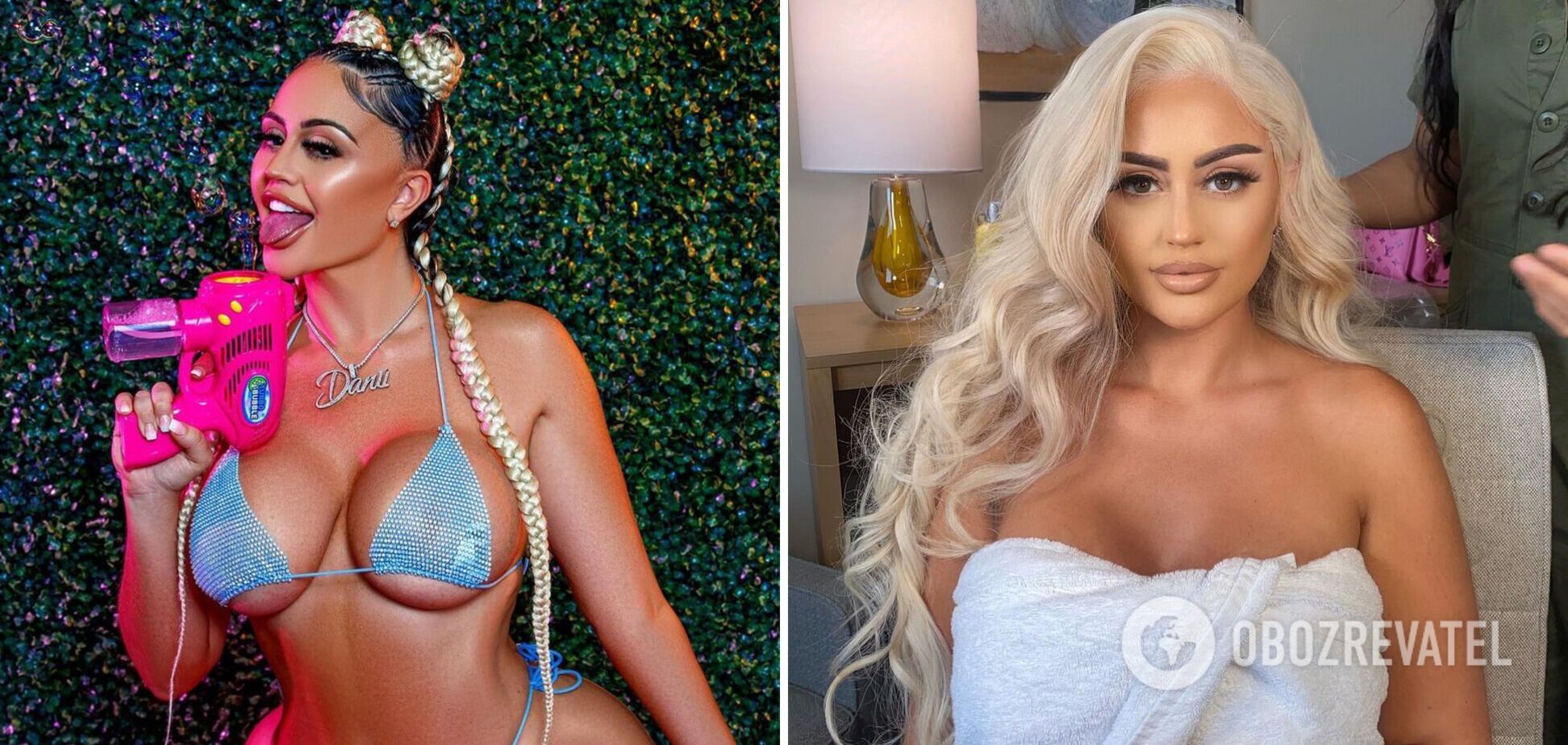 21-летняя модель спустила 10 тысяч долларов на увеличение ягодиц и сильно пожалела об этом. Фото