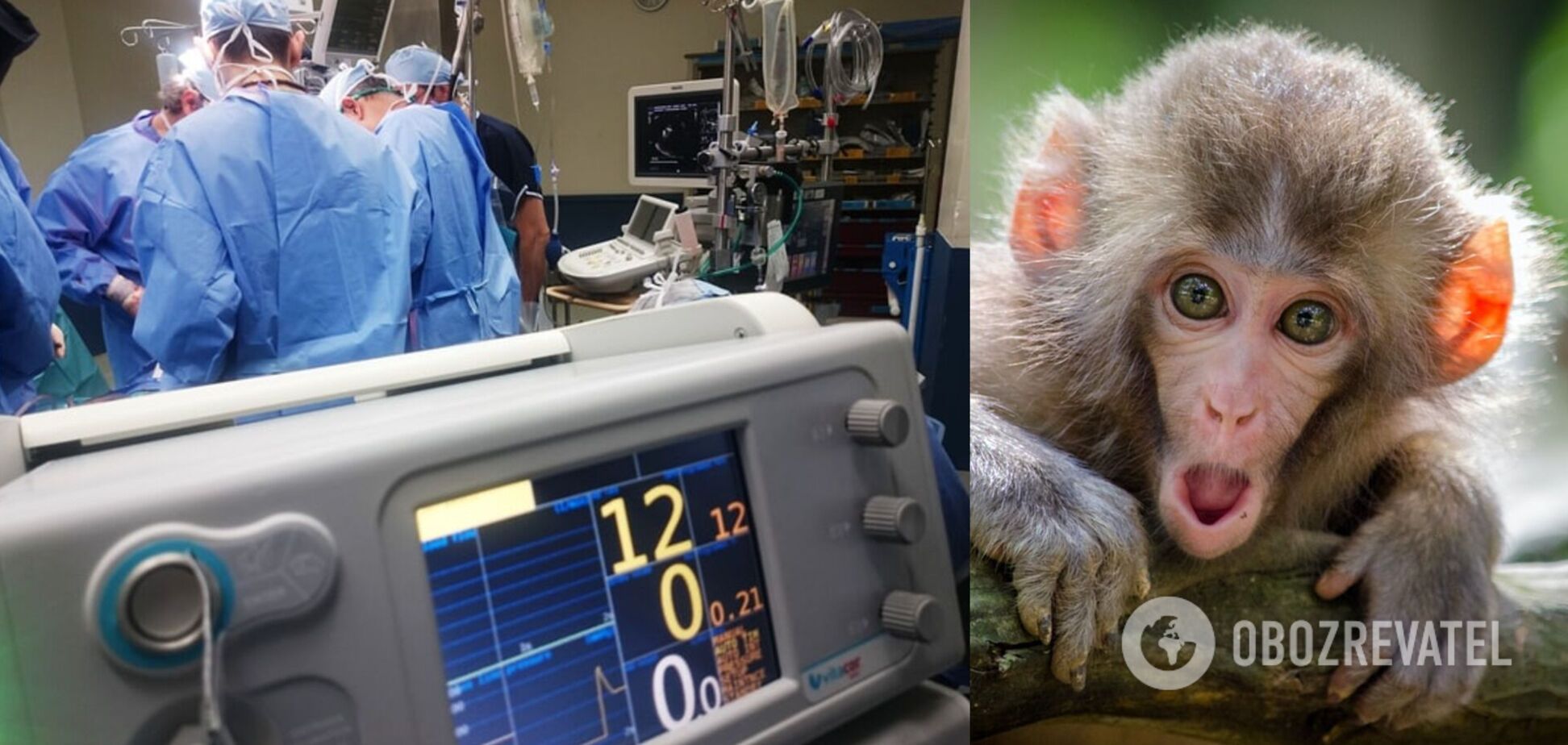 В КНР зафиксирован первый случай смерти человека, заразившегося вирусом обезьяны