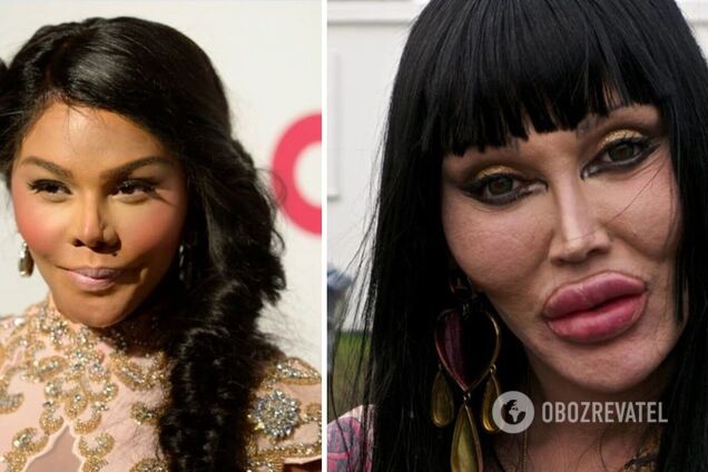 Девушки недовольны пластикой носа