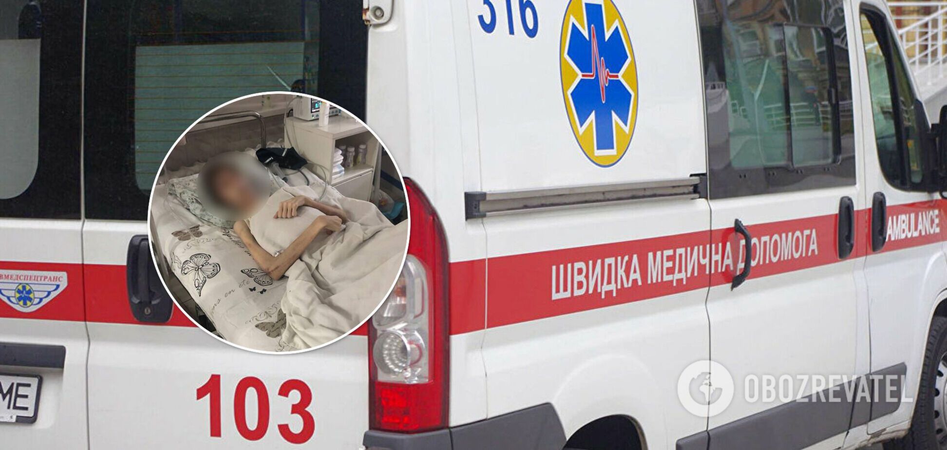 В Одессе родители 'духовным лечением' довели ребенка до истощения и обезвоживания. Фото