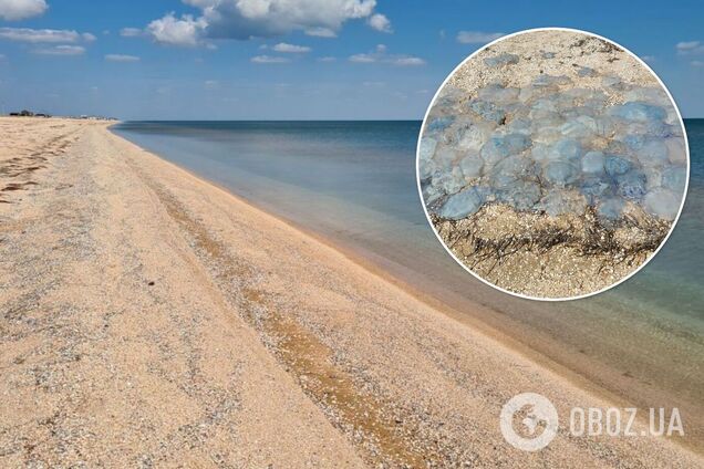 Полдня ходил с ожогами: туристы пожаловались на отдых на Арабатской Стрелке. Фото и видео