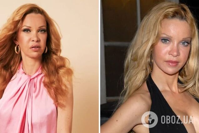 43-річна модель зробила 360 косметичних процедур: як виглядає зірка зараз. Фото