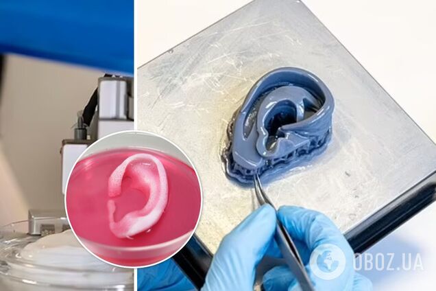 Ученые напечатали на 3-D принтере человеческое ухо: спасет пострадавших в пожарах и рожденных с деформациями. Фото