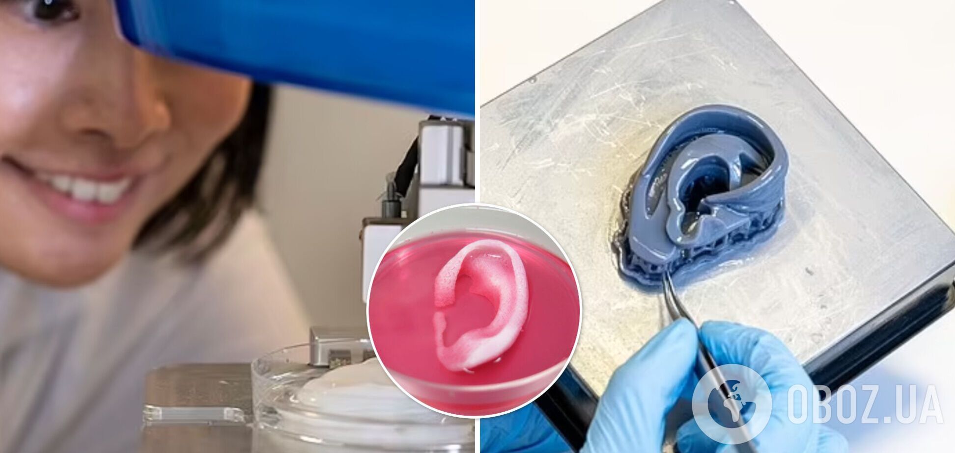 Ученые напечатали на 3-D принтере человеческое ухо: спасет пострадавших в пожарах и рожденных с деформациями. Фото