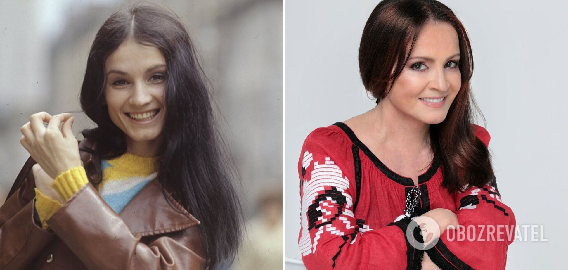 Какие пластические операции делала София Ротару: ответ хирурга