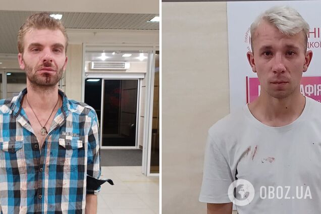 Во Львове совершили нападение на уличного музыканта и поэта: забрызгали баллончиком и избили. Фото