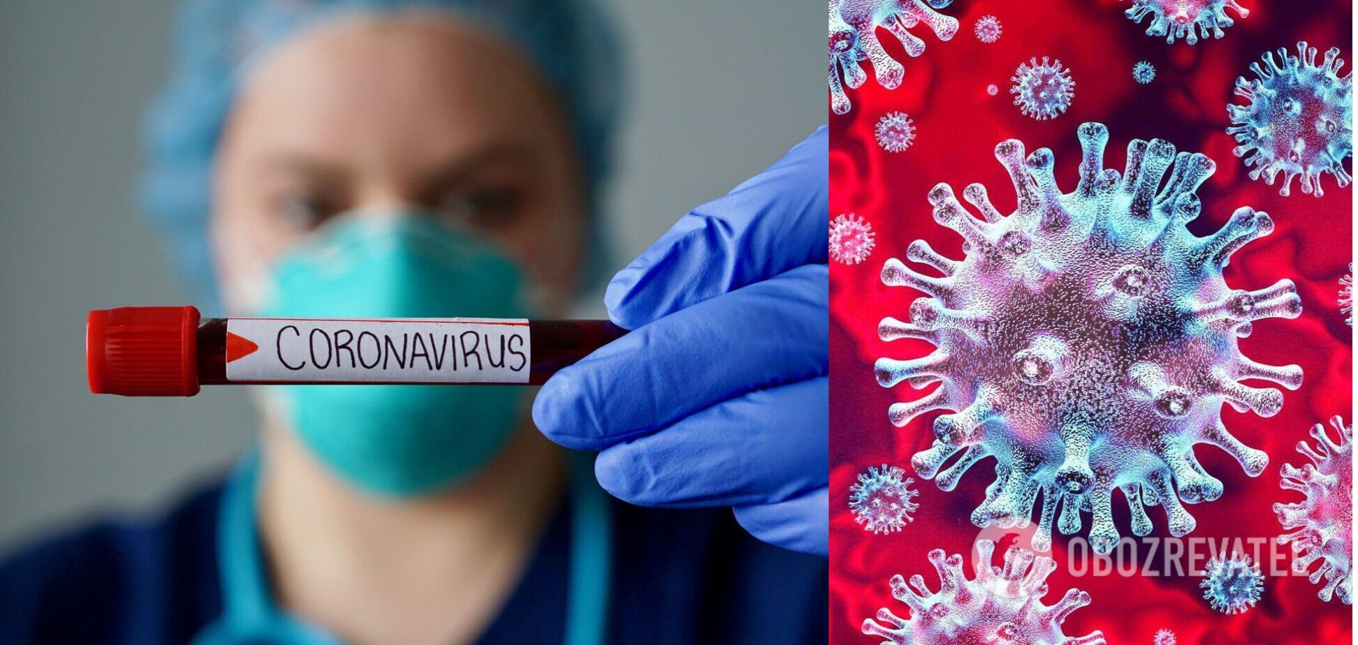 В Украине за сутки коронавирусом заболели почти 400 человек