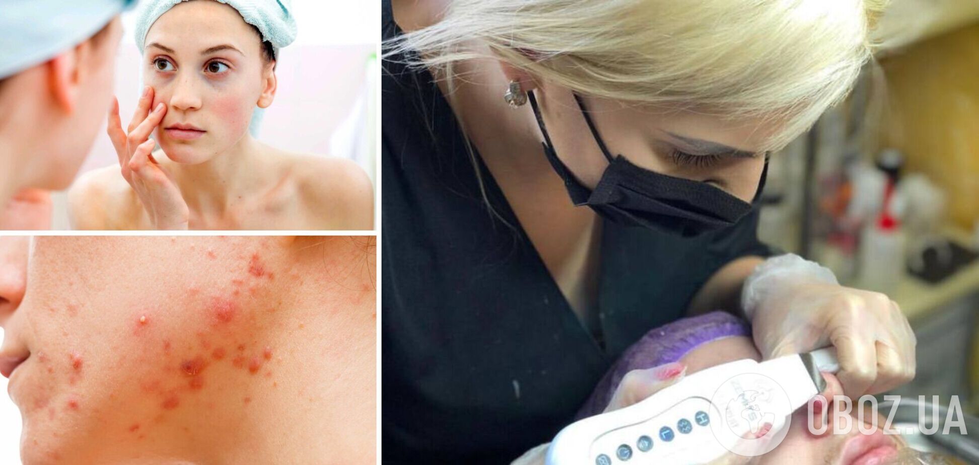 Люди не вовремя обращаются за помощью к врачу