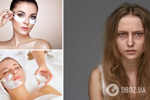 Темні кола під очима є проблемою для багатьох людей