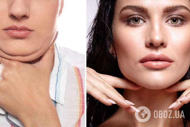 Дівчата часто звертаються з цією проблемою до професіоналів