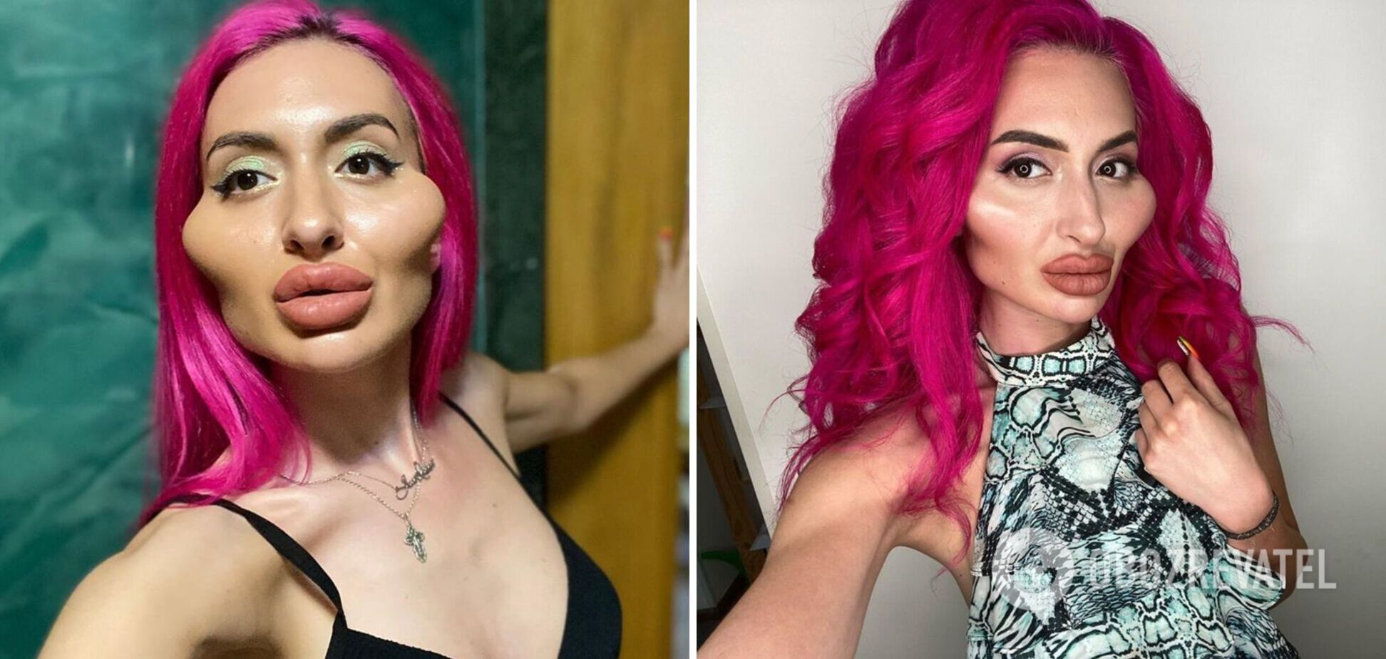 Українка з величезними вилицями показала себе без пластики. Фото