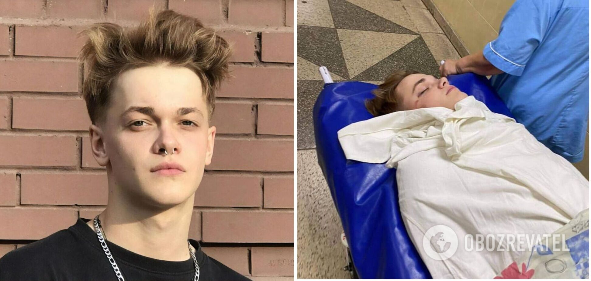 К избитому танцору Нади Дорофеевой не пускают даже маму: у него открытая рана 10 на 10 см