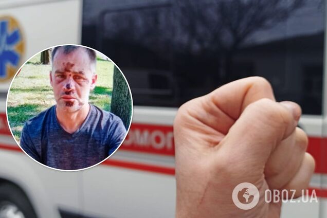 В Киеве неадекватный мужчина набросился на медиков с кинжалом и разбил скорую. Фото