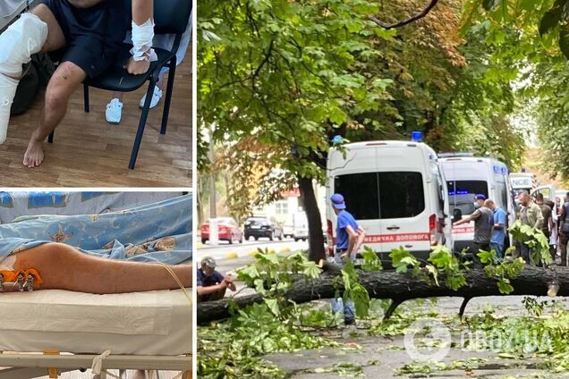 До Києва прилетів новий борт із пораненими на Донбасі: волонтерка просить про допомогу військовим. Фото