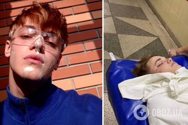 Избитый танцор Дорофеевой впервые вышел на связь: впереди путь реабилитации