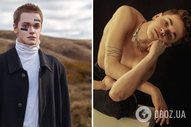 Что известно об избитом танцоре Нади Дорофеевой. Фото