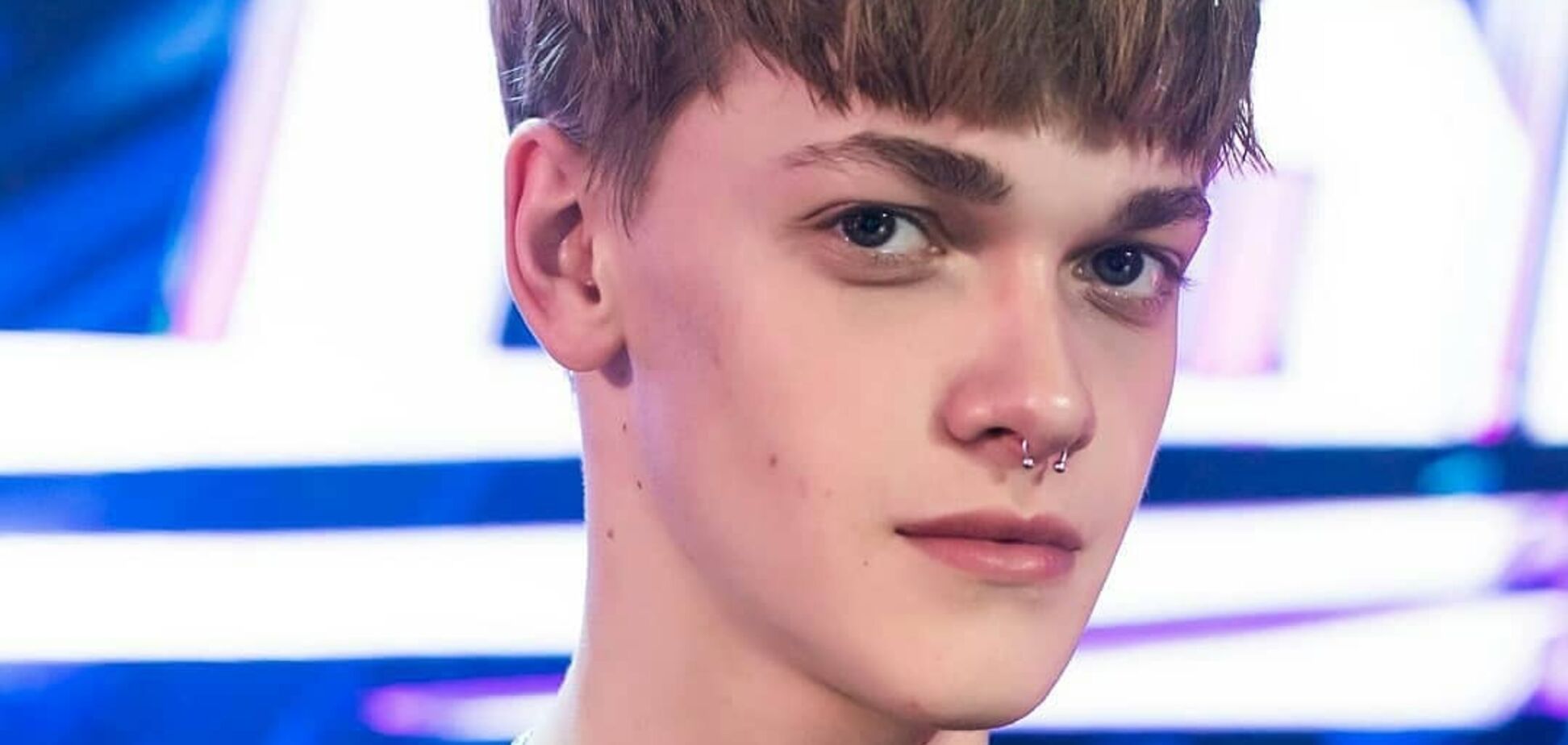 Избитого танцора Дорофеевой выписали из больницы после 15-дневной комы. Фото