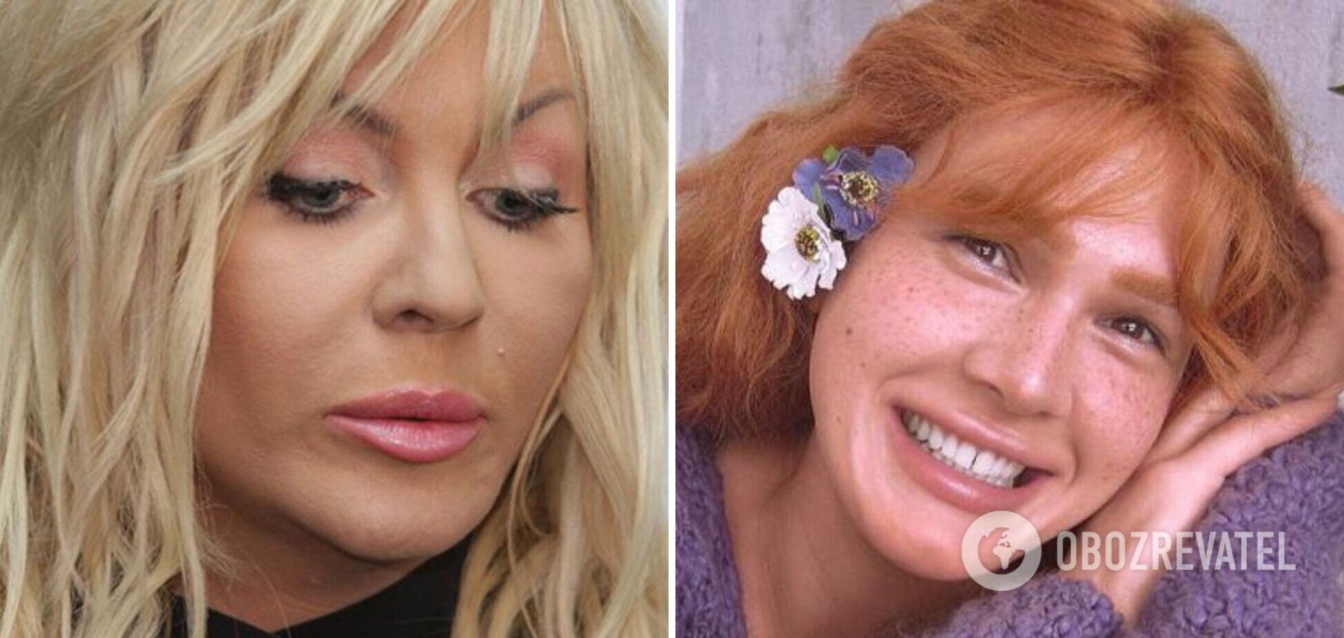 Українські співачки найчастіше роблять пластику грудей, носа і підтяжку обличчя